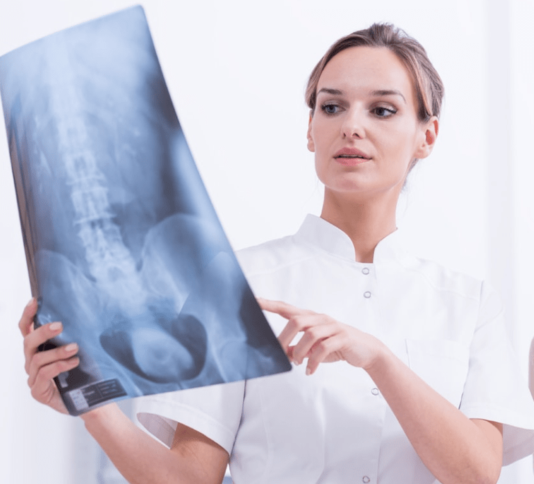 A mellkasi osteochondrosis diagnosztizálása röntgenvizsgálattal